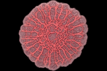 A mutant strain of P. aeruginosa forms a hyper-wrinkled bacterial colony with prominent spokes. image: Yu-Cheng Lin/Columbia University